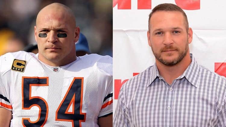 Brian Urlacher's hair treatment