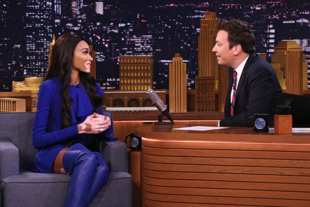 Winnie Harlow in The Tonight Show with Jimmy Fallon (Source: Twitter)