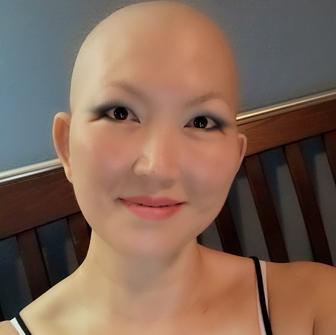 Jeanette Lee no hair cancer