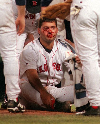 Bryce Florie after the hit