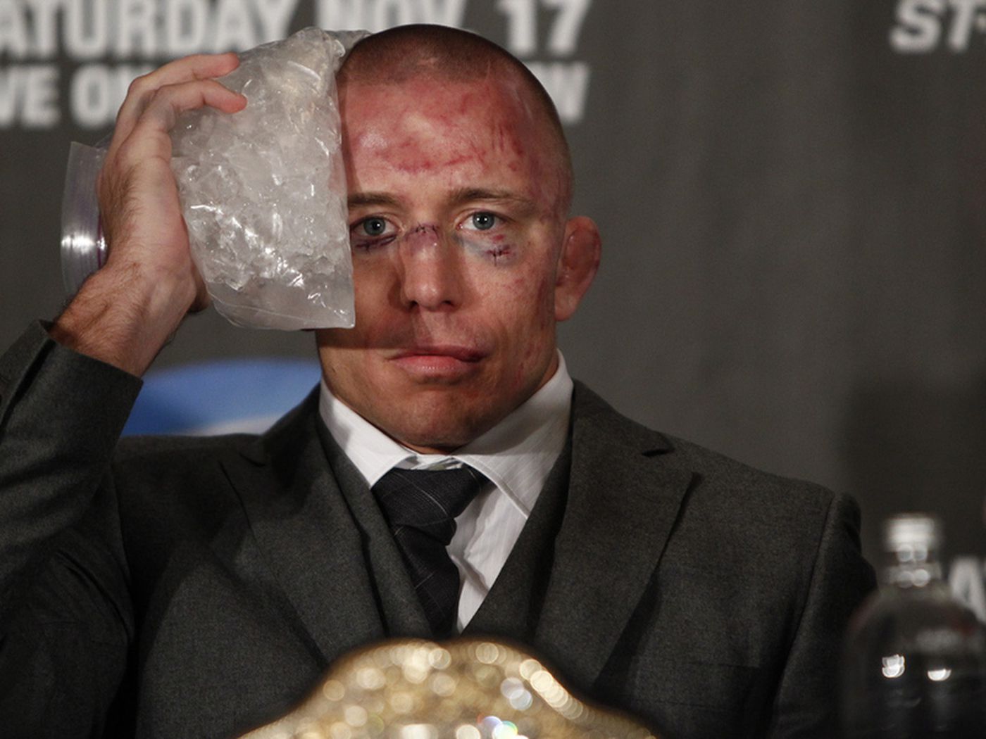 St-Pierre All Bruised After A Fight