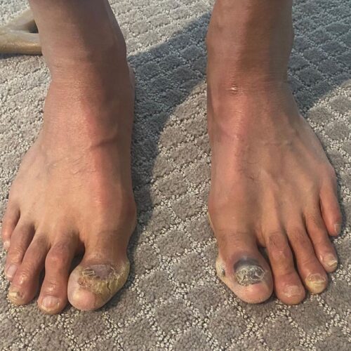 David Goggins Feet