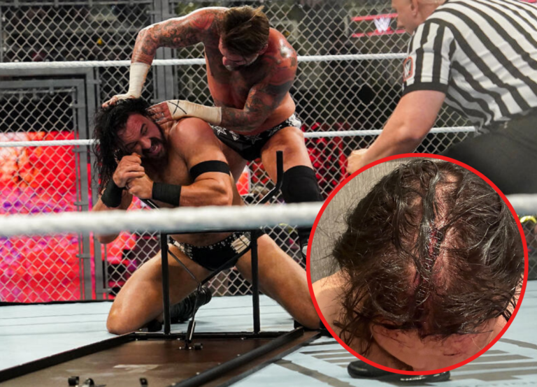 Drew McIntyre Left Bloodied And Needing Stitches After Brutal Hate Fueled Match With CM Punk