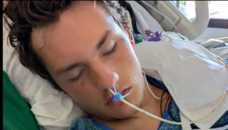 Oliver Baerman Brain Injury