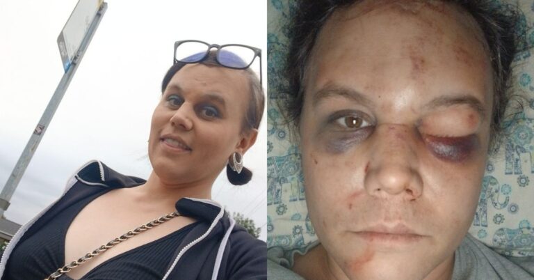 Renton Woman Beaten