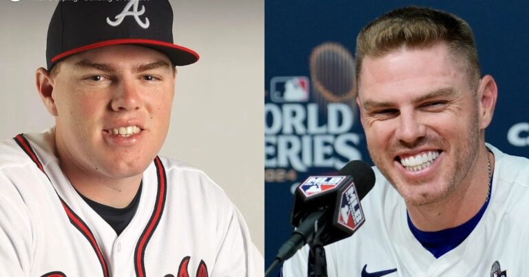 Freddie Freeman Teeth