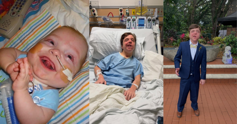 Dalton brain Tumor