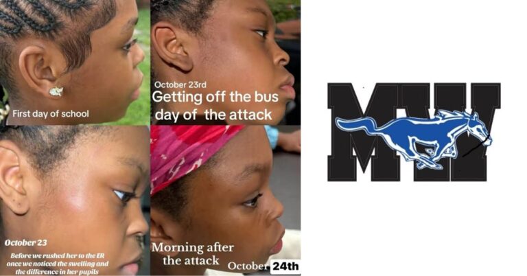 Mac Williams Middle School Student Bleeding